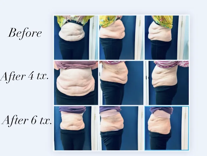 Skin By Heather Picture 5