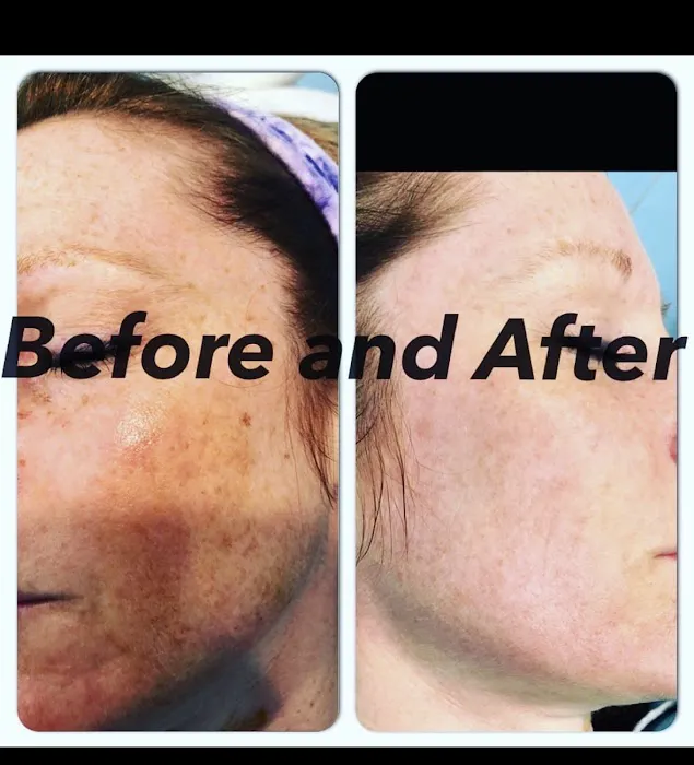 Skin By Heather Picture 6