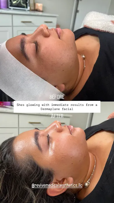 Revive Medical Aesthetics Picture 1