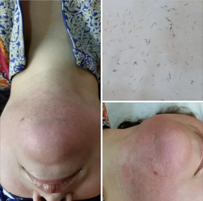 Silk Skin Laser Care Picture 4