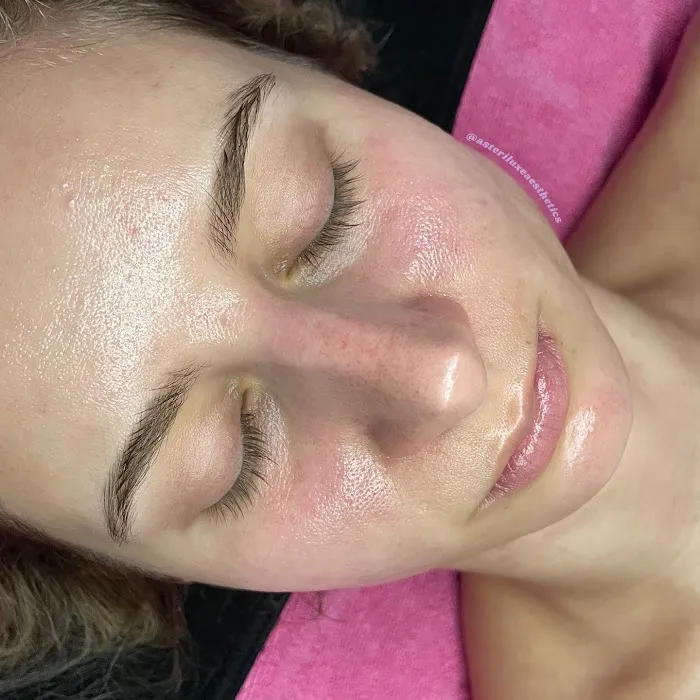 Asteri Luxe Aesthetics Picture 8