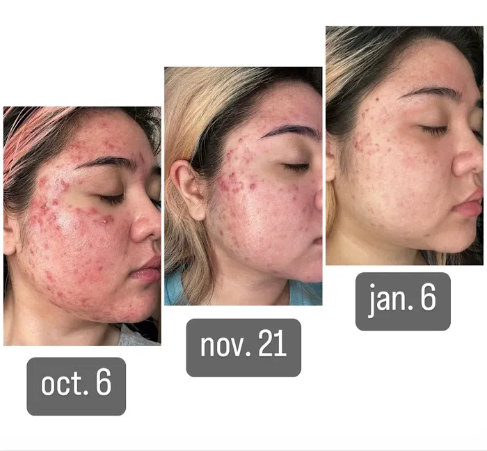 Asteri Luxe Aesthetics Picture 4