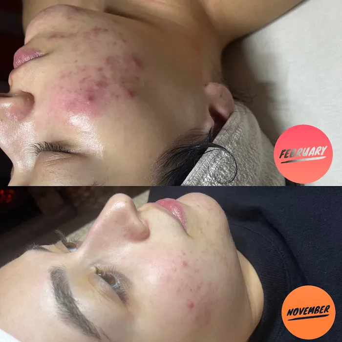 Demi Aesthetics Picture 10