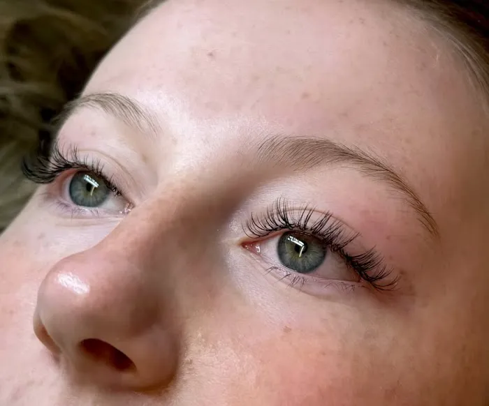 Berks Esthetics Picture 10