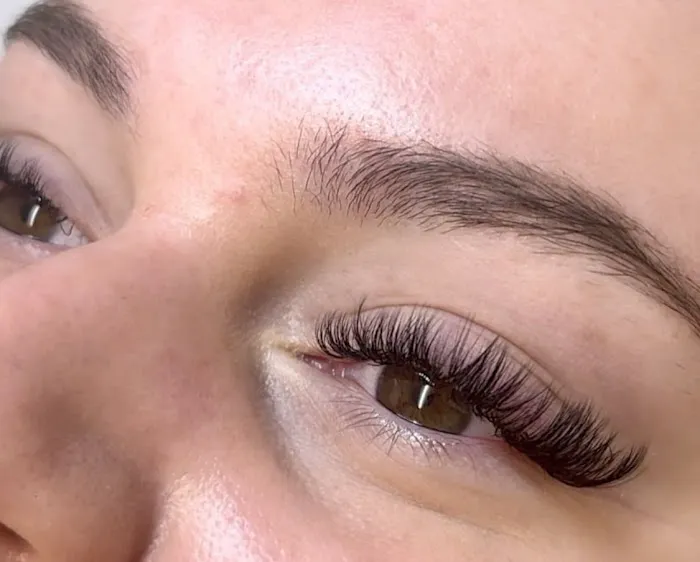 Berks Esthetics Picture 3