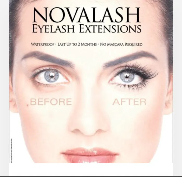 Berks Esthetics Picture 9