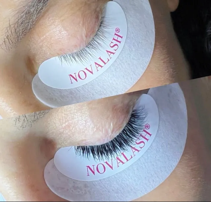 Berks Esthetics Picture 7