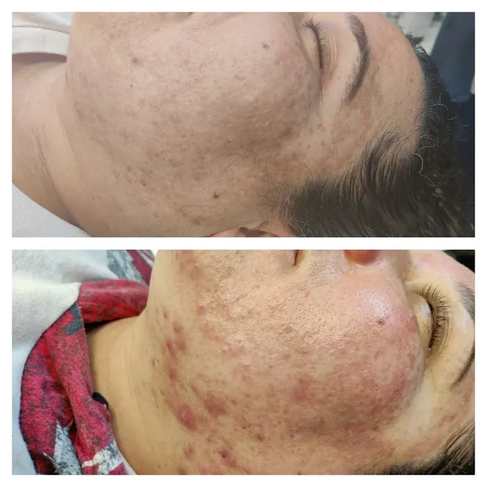 Clearly Beautiful Skin and Acne Clinic Picture 6