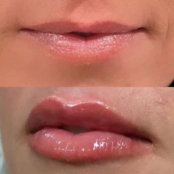 Anllo Center for Aesthetics Picture 4