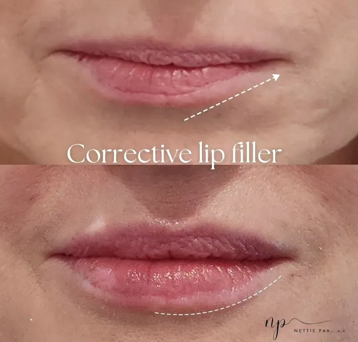 Anllo Center for Aesthetics Picture 2