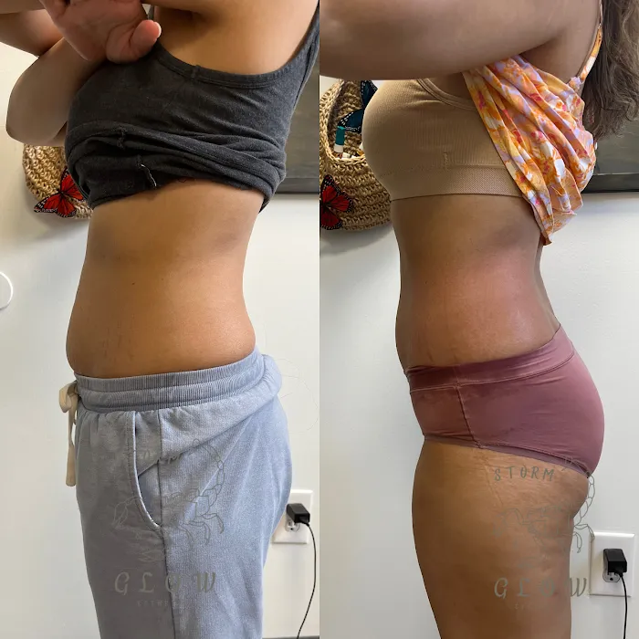 Storm&Glow Esthetics Picture 5