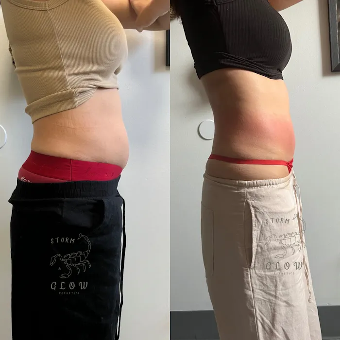Storm&Glow Esthetics Picture 10