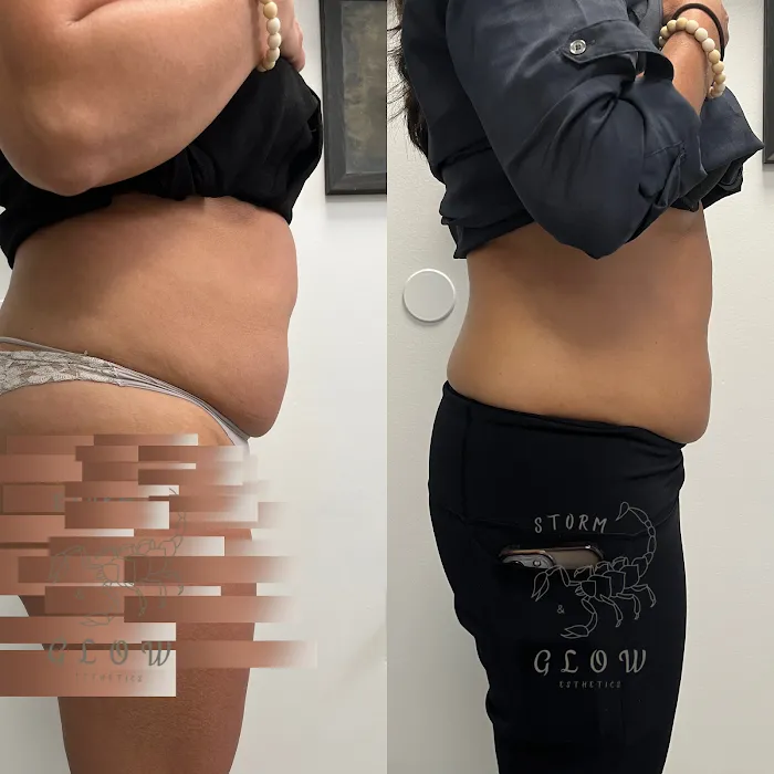 Storm&Glow Esthetics Picture 2