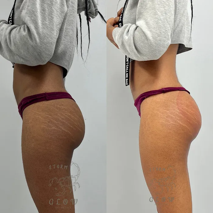 Storm&Glow Esthetics Picture 3