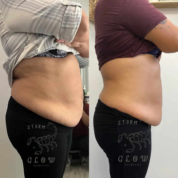 Storm&Glow Esthetics Picture 4