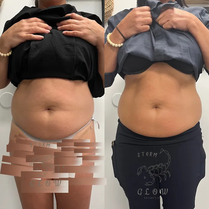 Storm&Glow Esthetics Picture 7