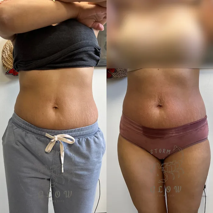 Storm&Glow Esthetics Picture 8