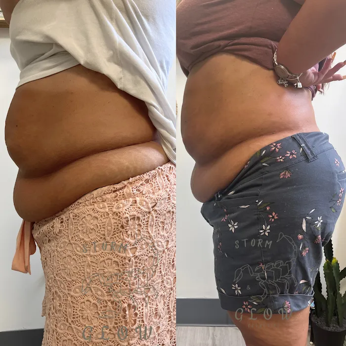 Storm&Glow Esthetics Picture 9