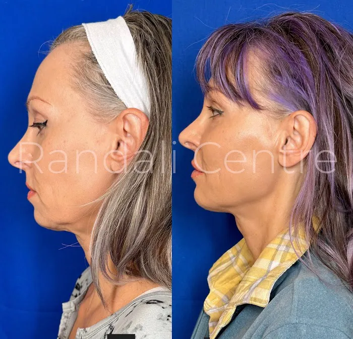 Randali Centre for Aesthetic Medicine Picture 5