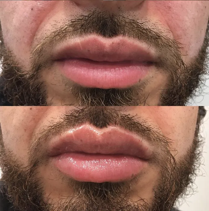 Meesha Aesthetics Picture 10