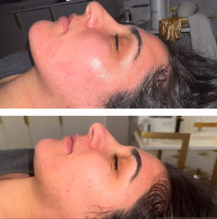 Micha Esthetics Picture 4