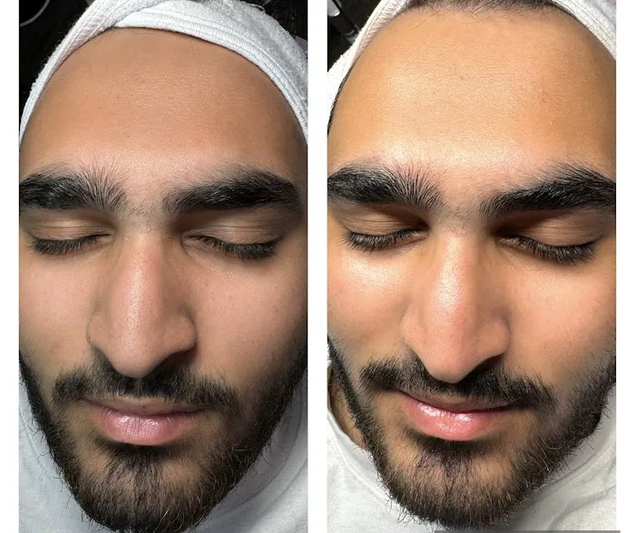 Micha Esthetics Picture 10