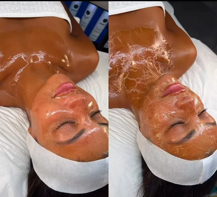 Micha Esthetics Picture 8