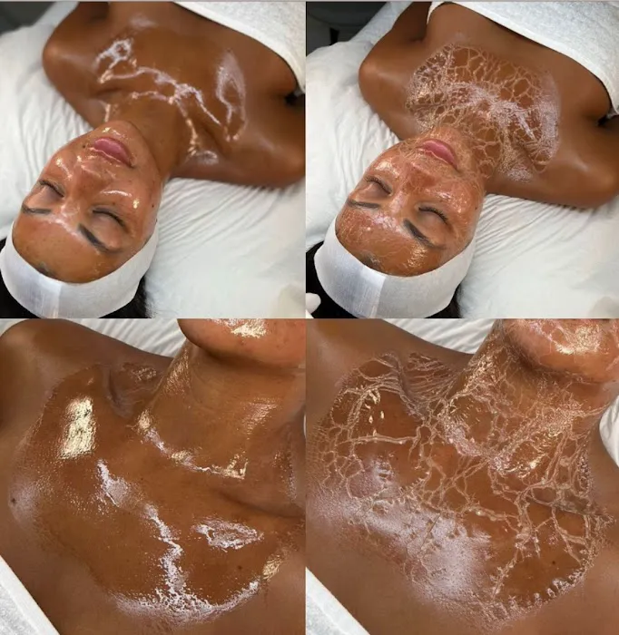 Micha Esthetics Picture 9