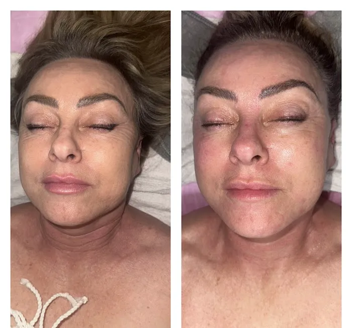 Micha Esthetics Picture 3