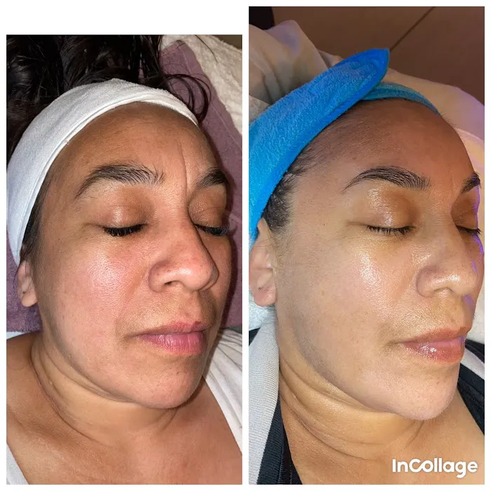 Sunset Aesthetics LLC Picture 7