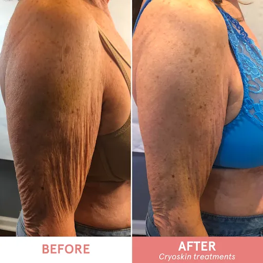 Sunset Aesthetics LLC Picture 10