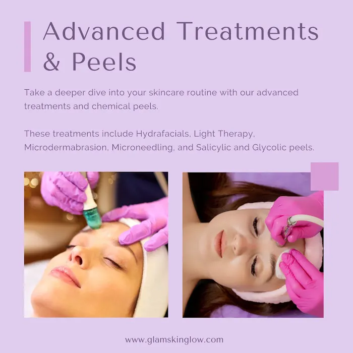 Glamorous Skin Glow Picture 2