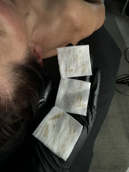 EnhancedbyB Esthetics Picture 3