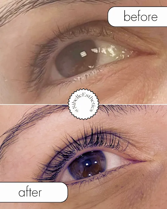 Sibelle Esthetics Picture 10