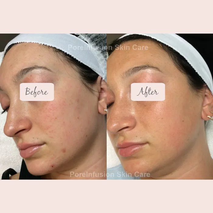 Envision Acne & Skin Care Center Picture 5