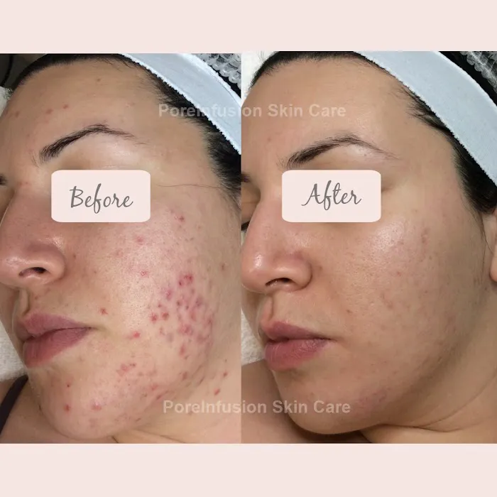 Envision Acne & Skin Care Center Picture 2