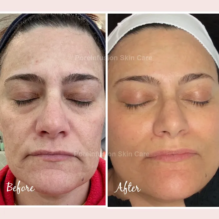 Envision Acne & Skin Care Center Picture 10