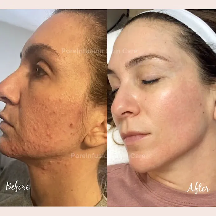 Envision Acne & Skin Care Center Picture 4