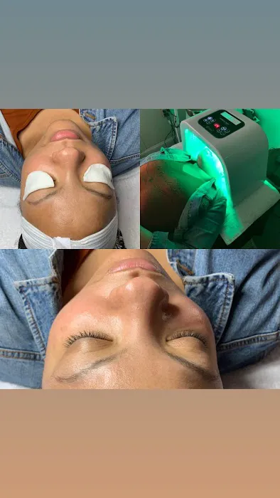 Mydas Advanced Esthetics LLC Picture 8