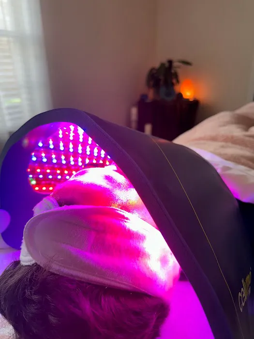 Face of Grace Picture 8