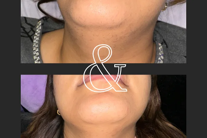 The Vanity Bar - Matawan, NJ Picture 9