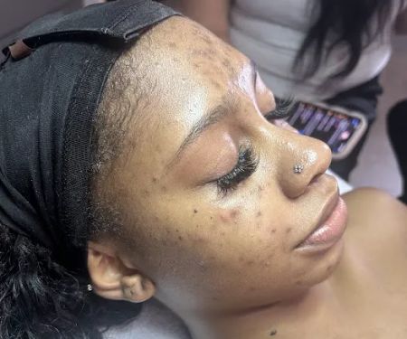 The Clear Skin Collective