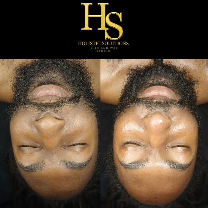 Holistic Solutions Skin And Wax Studio Picture 7