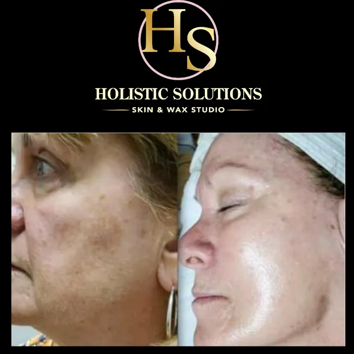 Holistic Solutions Skin And Wax Studio Picture 3