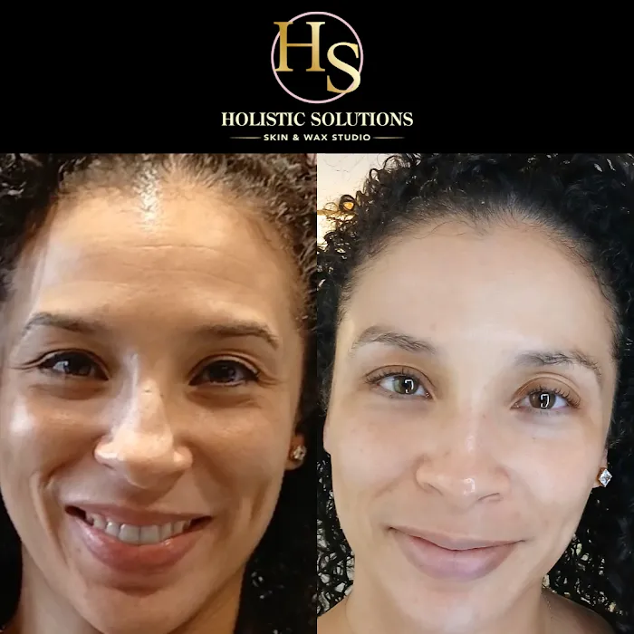 Holistic Solutions Skin And Wax Studio Picture 8