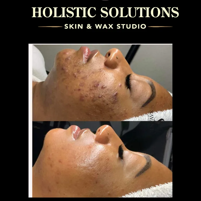 Holistic Solutions Skin And Wax Studio Picture 5