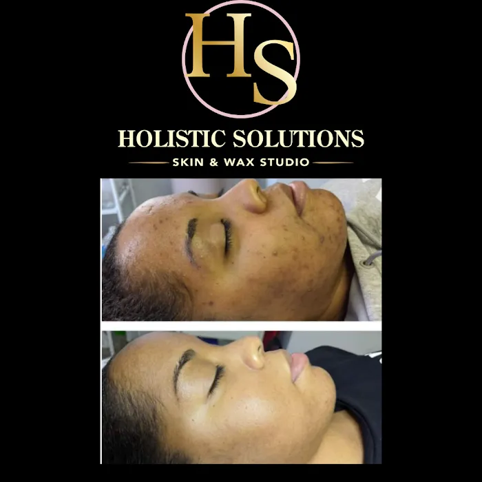 Holistic Solutions Skin And Wax Studio Picture 6