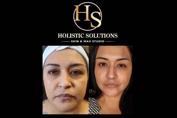 Holistic Solutions Skin And Wax Studio Picture 4