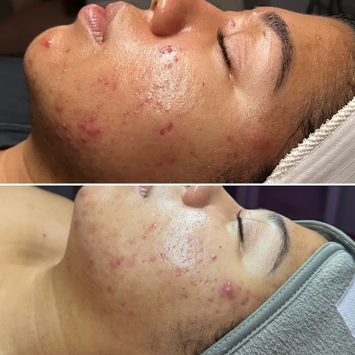 I'd Mask That Picture 1