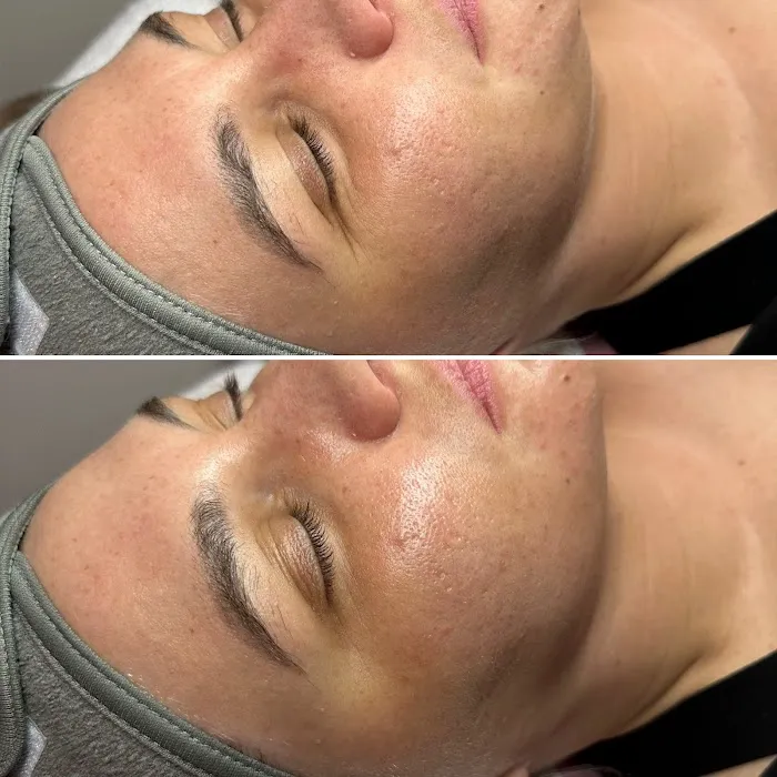 I'd Mask That Picture 10